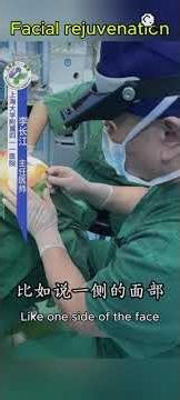 Why does your thread lift make your face wider?