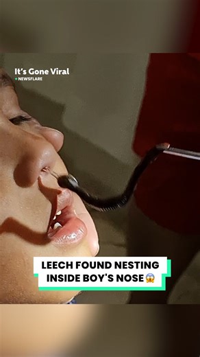 580K views · 1.3K reactions | It's been in there for a month  | IGV | Facebook