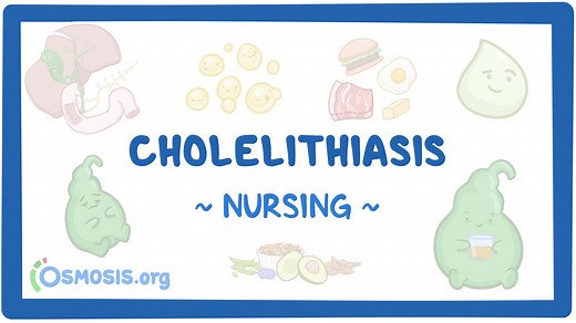 Cholelithiasis: Nursing: Video & Causes | Osmosis