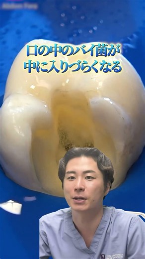 虫歯治療の工程を解説【現役歯科医】#shorts #歯医者 #虫歯治療