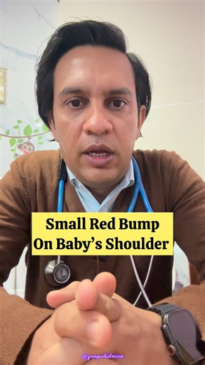 Dr Puneet Anand | Pediatrician & Parenting Expert on Instagram: "Doctor I noticed I small red bump/pustule on baby’s left shoulder. I am worried , what to do ? 👉🏻 This is a normal BCG vaccine reaction. 👉🏻 It usually starts as a small red bump at the injection site, which may later turn into a tiny pustule or shallow ulcer. There can be mild oozing for a short period, after which it gradually heals on its own and finally leaves a small permanent scar, which is completely normal and painless. 