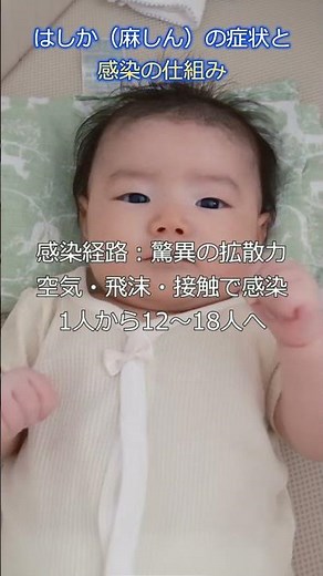 【潜伏期間】はしか（麻しん）の症状と感染の仕組み