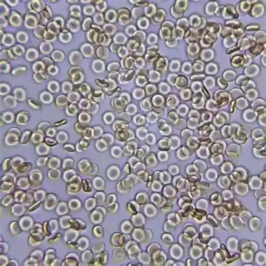 2.3K views · 38 reactions | Une goutte de sang permet d'observer de...