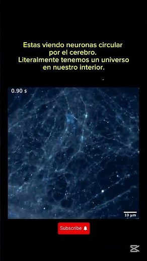 🧠✨ ¡El Cerebro como Microcosmos! Imagen de Neuronas que Asemeja al Universo 🌌 #nasa