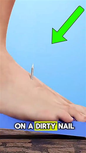 Why Stepping on a Dirty Nail Can Be Serious?😱⚠️