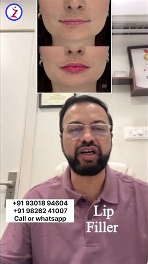Thread Lift Surgery In Delhi Mumbai Bangalore Kolkata Hyderabad Chandigarh Lucknow Raipur Nagpur