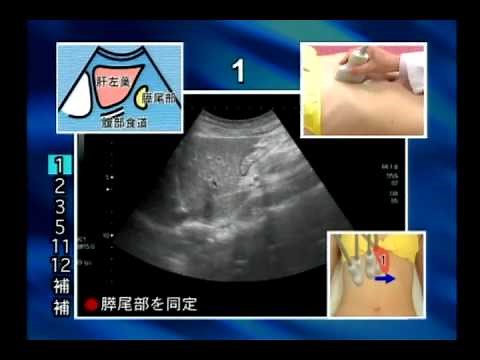 “の”の字2回走査法で出来る！超音波手技大原則 サンプル動画① - 臨床医学チャンネルCareNeTV