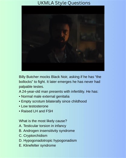 What is the most likely cause? A. Testicular torsion in infancy B. Androgen insensitivity syndrome C. Cryptorchidism D. Hypogonadotropic hypogonadism E. Klinefelter syndrome ✔️ Correct answer: C – Cryptorchidism Explanations A. Testicular torsion in infancy – Incorrect Would usually present with acute pain and often unilateral loss. B. Androgen insensitivity syndrome – Incorrect Patients have female external genitalia despite XY karyotype. C. Cryptorchidism – Correct Failure of testicular descen