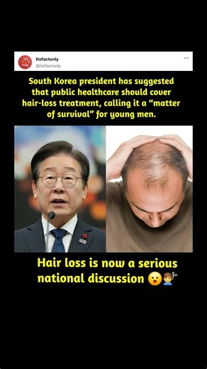 Public healthcare should cover hair-loss treatment #facts #news