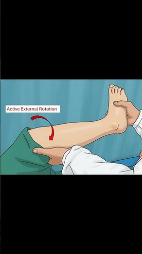 Garrick Test for Popliteus Tendinopathy Explained #kneepain #meded #ATC #physio #ortho