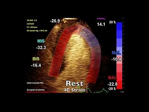 Stress Echo Dobutamine Contraste Sonovue Strain
