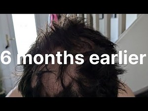 FIXING cars helped me through my TOUGHEST of times. Buying & selling cars profit breakdown