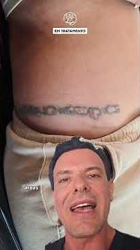 When tattoo removal goes wrong: necrosis and ulceration explained ⚡