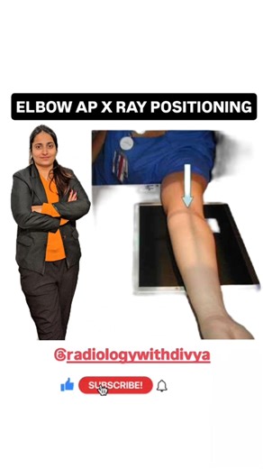X Ray positioning of elbow AP view #radiographer #medical #science