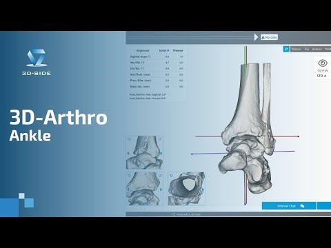 3D-Arthro Ankle: Clear Planning Supported by AI