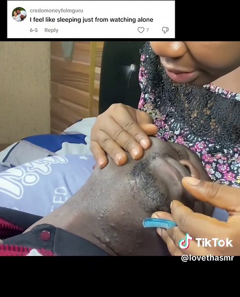 Pimple Popping ASMR for Relaxation