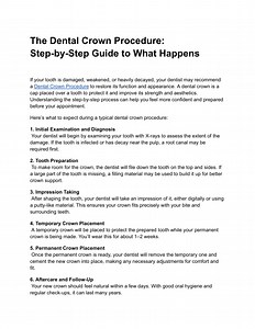 The Dental Crown Procedure_ Step-by-Step Guide to What Happens - SlideServe