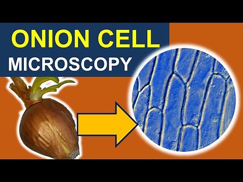 Observing moving CELL ORGANELLES of an ONION under the microscope