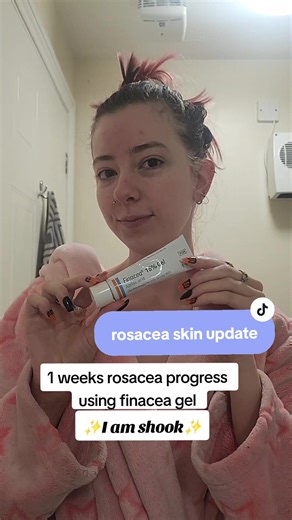 1 week on finacea and I already feel so much happier with my skin 🥹🫶 #rosacea #rosaceaskincare #finacea #finaceagel #azelaicacid #skincaresolution