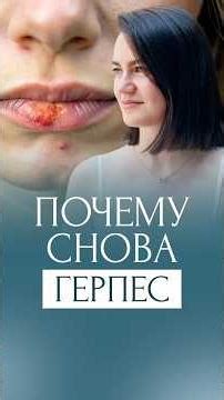 Почему часто появляется ГЕРПЕС? Стресс, иммунитет, ЖКТ и вирус герпеса | Как помочь организму