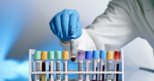 Hématocrite : pourquoi est-elle trop basse ou trop élevée ?