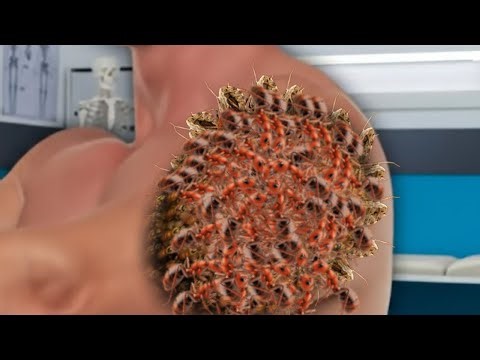 Deep Cleaning Animation ASMR—Removing Ticks, Maggots & Insects From Arm (Satisfying & Relaxing)