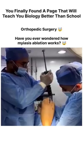 biology facttss on Instagram: "Have you ever wondered how myiasis ablation actually works? Myiasis happens when fly larvae (maggots) infest living tissue, usually in open wounds, ulcers, or areas with poor hygiene. Treating it isn’t just about removing what you can see—it’s about forcing every larva out, alive or dead, so the tissue can heal properly. The process begins by cutting off the larvae’s oxygen supply. Substances like turpentine oil, petroleum jelly, liquid paraffin, or chloroform in o