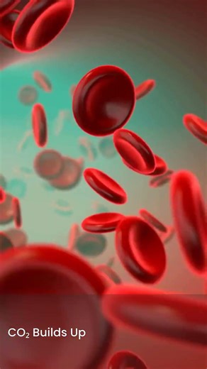 Why CO₂ Narcosis Happens in COPD | RN Explains 123