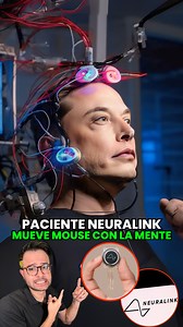 La primer persona en recibir el chip cerebral de Elon Musk ahora es capaz de controlar un mouse con su mente! #ElonMusk #Neuralink #Noticias | Candres Peredo