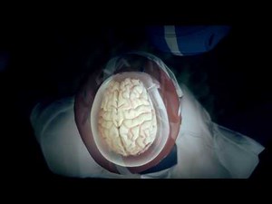 Does Aaron Hernandez's 'Severe' CTE Explain His Violent Behavior? | Oxygen