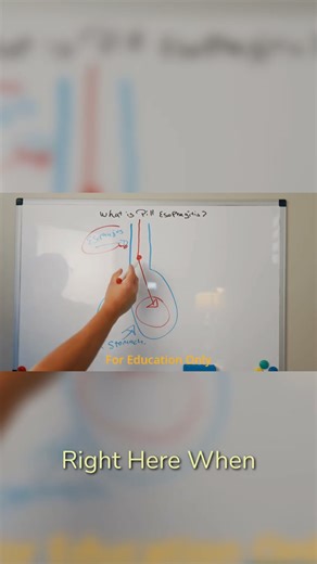 Medication Stuck? How Pill-Induced Esophagitis Happens 💊
