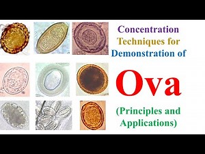 Concentration Technique for Demonstration of Ova (Principles & Applications) | #bscmlt #bmlt_lecture