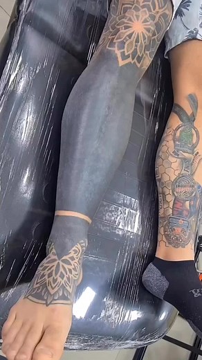 Black out leg sleeve tattoo removal procedure process tattoo removal artist Helltattoo #blackouttattoo #legsleeve #tattooremoval #worldsbesttattoos #besttattoos #tattootiktok #tiktoktattoo #tatuaje #tatuador #tattooartist