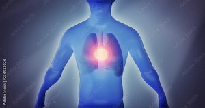 3D anatomy man suffering from lung disease, chest pain, asthma, emphysema, bronchitis, tuberculosis, pneumonia, cancer, infection or COPD on a dramatic background. Video a great for medical purposes.