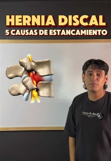 🗣️La hernia discal te esta pidiendo que cambies algo, ya sea dentro o fuera del gimnasio, es tu tarea analizar en qué estás fallando y comenzar a corregirlo, en este video te di algunos ejemplos, son las causas más comunes que hacen que una persona con hernia discal no se rehabilite por completo. . 🌟Si quieres que cree un plan de entrenamiento en donde vamos a tener comunicación constante para llevarte a la rehabilitación de tu hernia discal, dale click al enlace de mi perfil . Sigueme, subo v