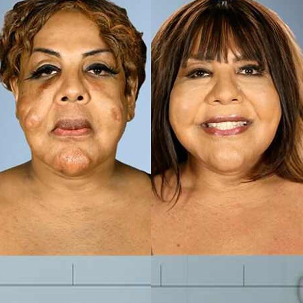 These Botched Plastic Surgery Before-and-After Photos Will Make Your Jaw Drop