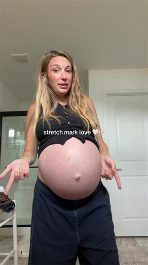 everybody is beautiful, ever pregnancy is beautiful. I remember being so sad and upset the first time I saw by body was growing purple marks all over my stomach, chest, hips and bum. And then I realized what a privilege it is to have tiger marks all over my body. I grew 4 babies and I’m dang proud of it. I’ll take all the stretch marks, loose skin and extra lbs any day of the week 🤍✌️ #thirdtrimestermama #40weekspregnant #bumpdate #dressmybumpwithme @Summer Fridays