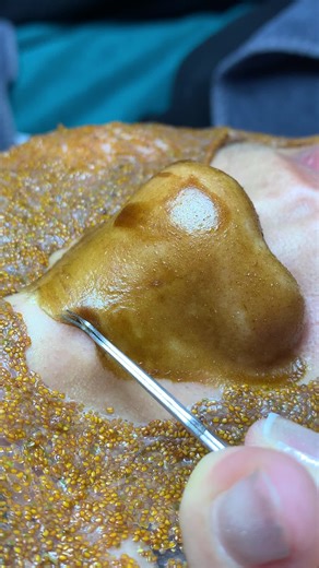 Chăm sóc da mặt tuyệt vời tại Lqspa & Academy