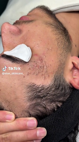 Aktiv Skincare Tips for Your Routine