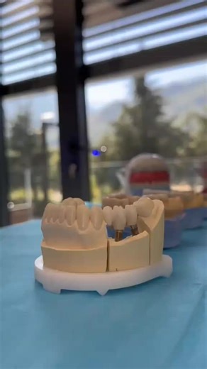 A dental crown is a tooth-shaped cap that restores a decayed, broken, weak or worn-down tooth. Dentists also use crowns to cover dental implants and root canal-treated teeth. Made from a variety of materials, including metal, resin and porcelain, crowns last between five and 15 years with proper care. #teeth #smile #dentist #dentistry #dental #tooth #teethwhitening #dentalcare #oralhealth #dentista #orthodontics #cosmeticdentistry #odontologia #veneers #dentalhygiene #braces #dentalclinic #denta