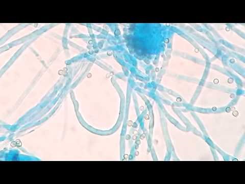 Aspergillus fumigatus Colony on SDA, LPCB tease mount under microscopy