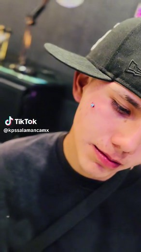 Microdermal Pómulo: Todo lo que Necesitas Saber