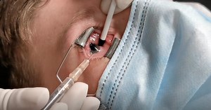 Complex Pediatric Pneumatic Retinopexy - Eyetube