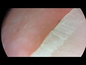 How Your Fingernails Look Under The Microscope