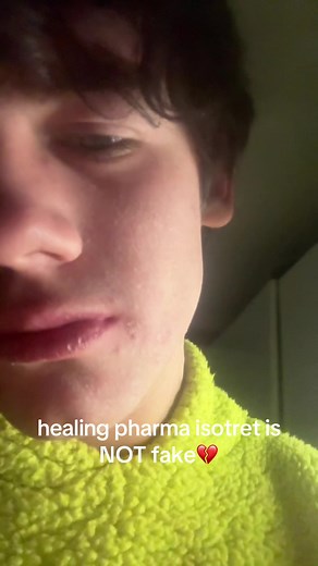 Healing Pharma Isotret for Acne Treatment