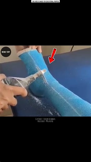 Amazing fact about Plaster Cutter Machine. 😮