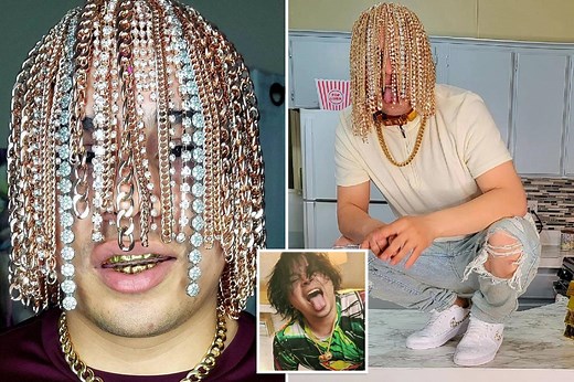 Rapper Dan Sur gets gold chain hooks surgically implanted into scalp