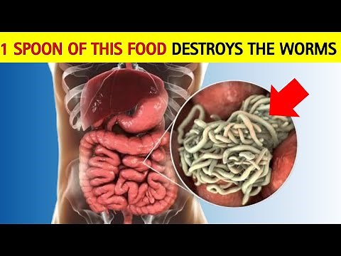 EXTERMINATE The Worms 14 Foods That Destroy Intestinal Parasites! [Healthpro]