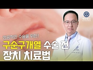 성공적인 수술을 위한 구순구개열 수술 전 장치 치료법