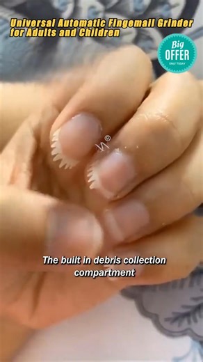 ✂️ Trim Your Nails, Not Your Confidence. Trimming thick or hard-to-reach nails can be a risky task, especially with shaky hands or fading eyesight. One slip is all it takes. Our Automatic Nail Grinder with 6 adjustable heads offers a safe, controlled alternative. It gently files nails smooth—no sharp blades, no painful nicks, and no risk of cuts or infection. Why It’s The Safer Choice: ✅ 6 Gentle Grinding Heads: For different nail types and desired smoothness. ✅ Easy-Grip Design: Made for less-t